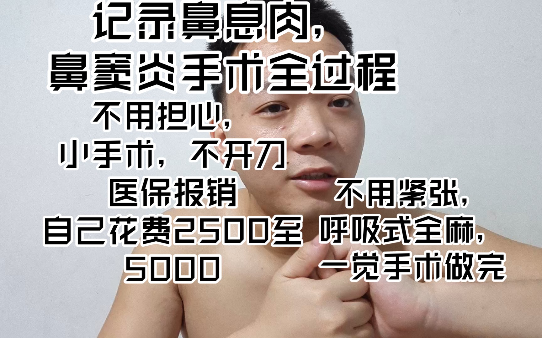 记录鼻息肉,鼻窦炎手术全过程.花销1万左右,医保可以报销,大概花费2500到5000左右.哔哩哔哩bilibili