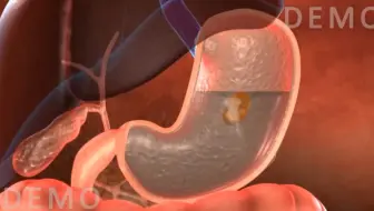 【生物学】3D演示-食物在胃部消化的过程