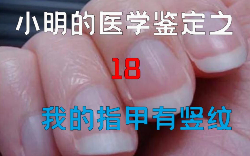 [图]【医学鉴定】网络热门医学视频鉴定18