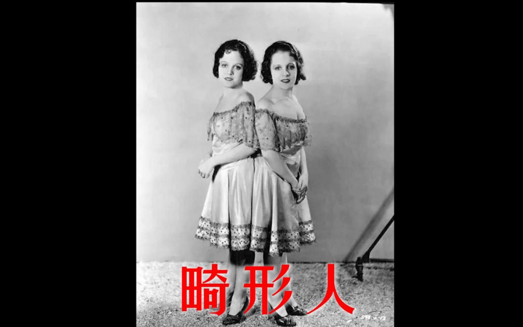 畸形人最真實的生活寫照#畸形人1932