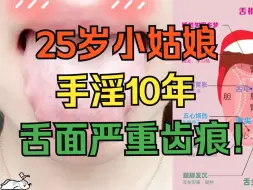 Download Video: 25岁小姑娘，手淫10年，舌面严重齿痕，再不及时调理，神仙难救！！