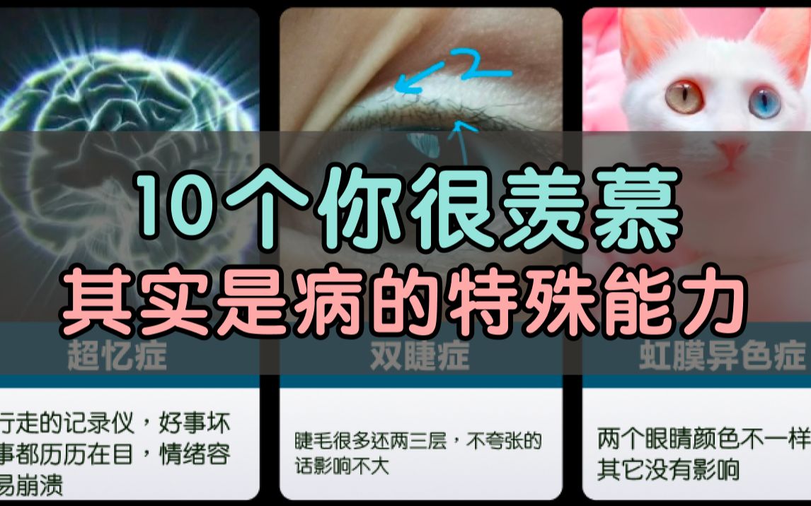 [图]10个你很羡慕，其实是病的特殊能力