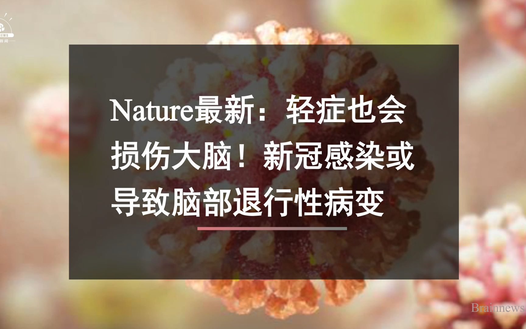 #Brainnews 【前沿快讯】 Nature最新:轻症也会损伤大脑!新冠感染或导致脑部退行性病变哔哩哔哩bilibili