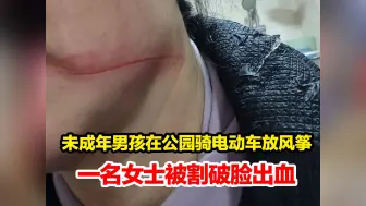 Descargar video: 未成年男孩在公园骑电动车放风筝，一名女士被风筝线割破脸出血