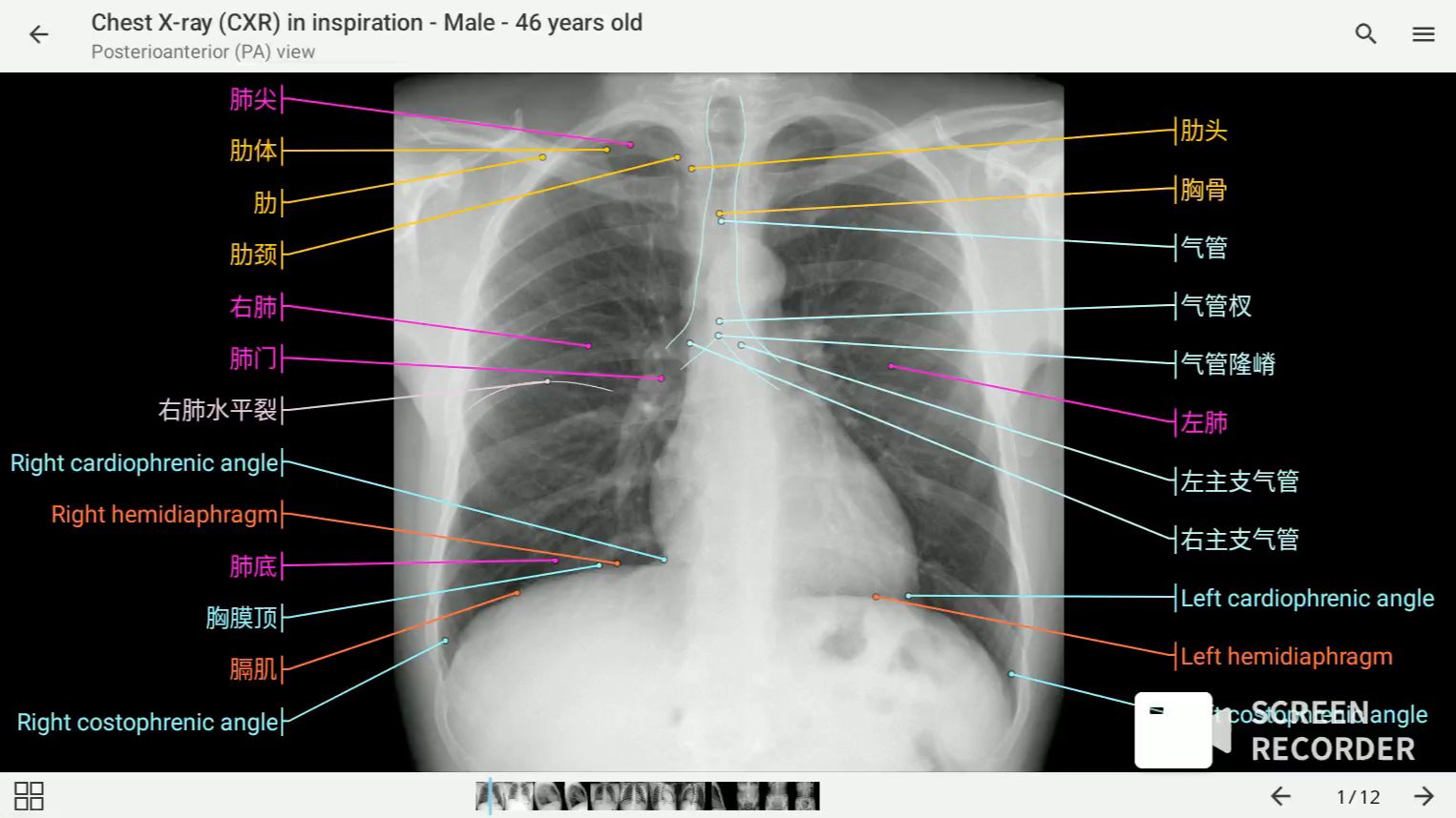 影像解剖图谱神器 医学影像学必备 e-anatomy中文最新版 胸部、腹部和骨盆X光片_哔哩哔哩_bilibili