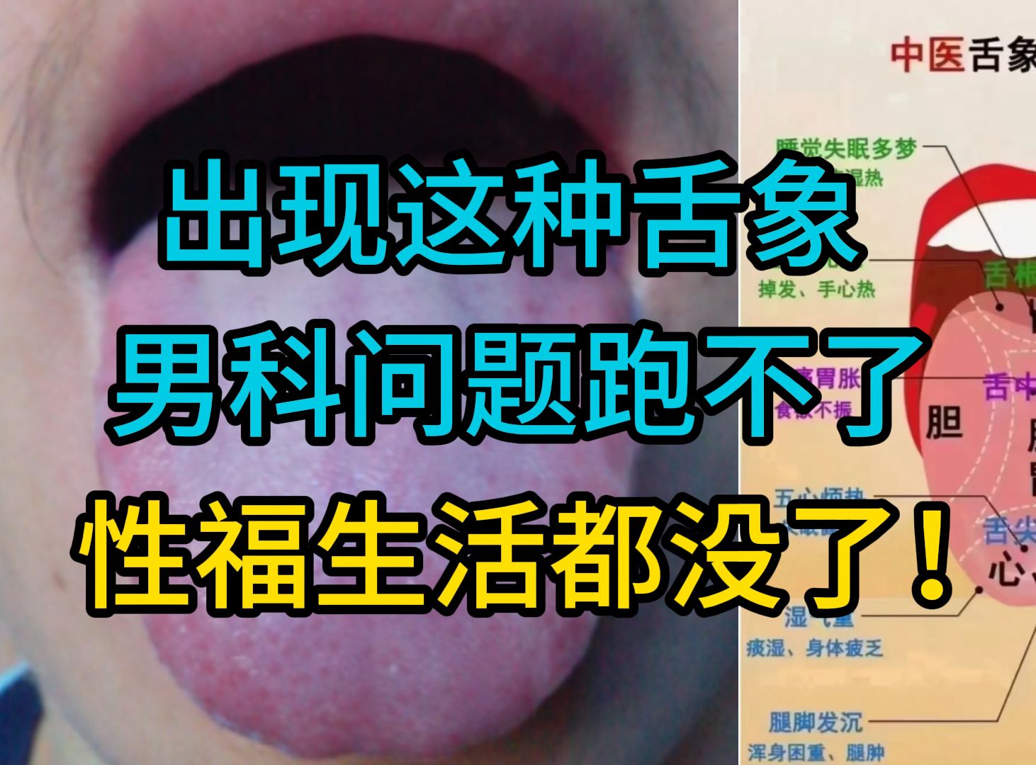 出现这种舌象,男科问题跑不了!性福生活都没了!哔哩哔哩bilibili