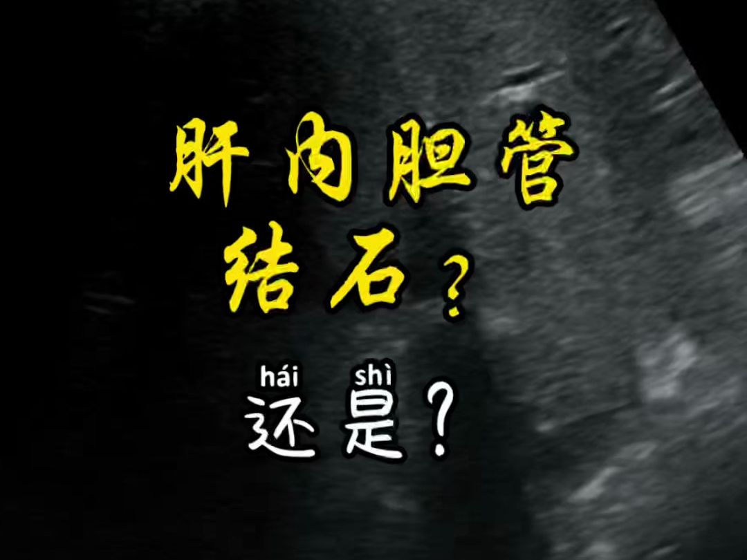肝内胆管结石吗?还是?看你超声基础好不好?
