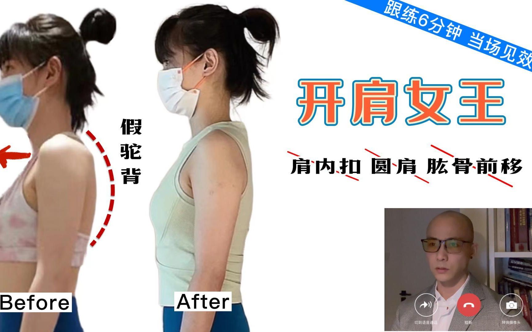【自用Yuuka】改善肩膀内扣+脖子前倾+正确沉肩。附中文解说！每天睡前一遍，两 - 哔哩哔哩