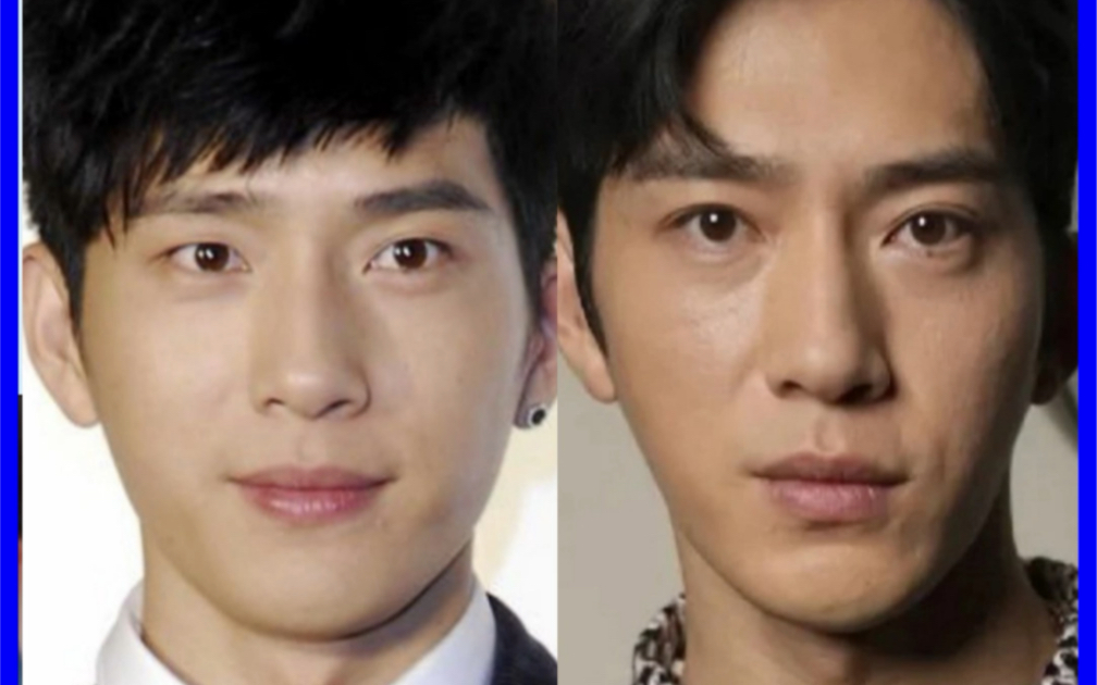 【整商】井柏然割了双眼皮?