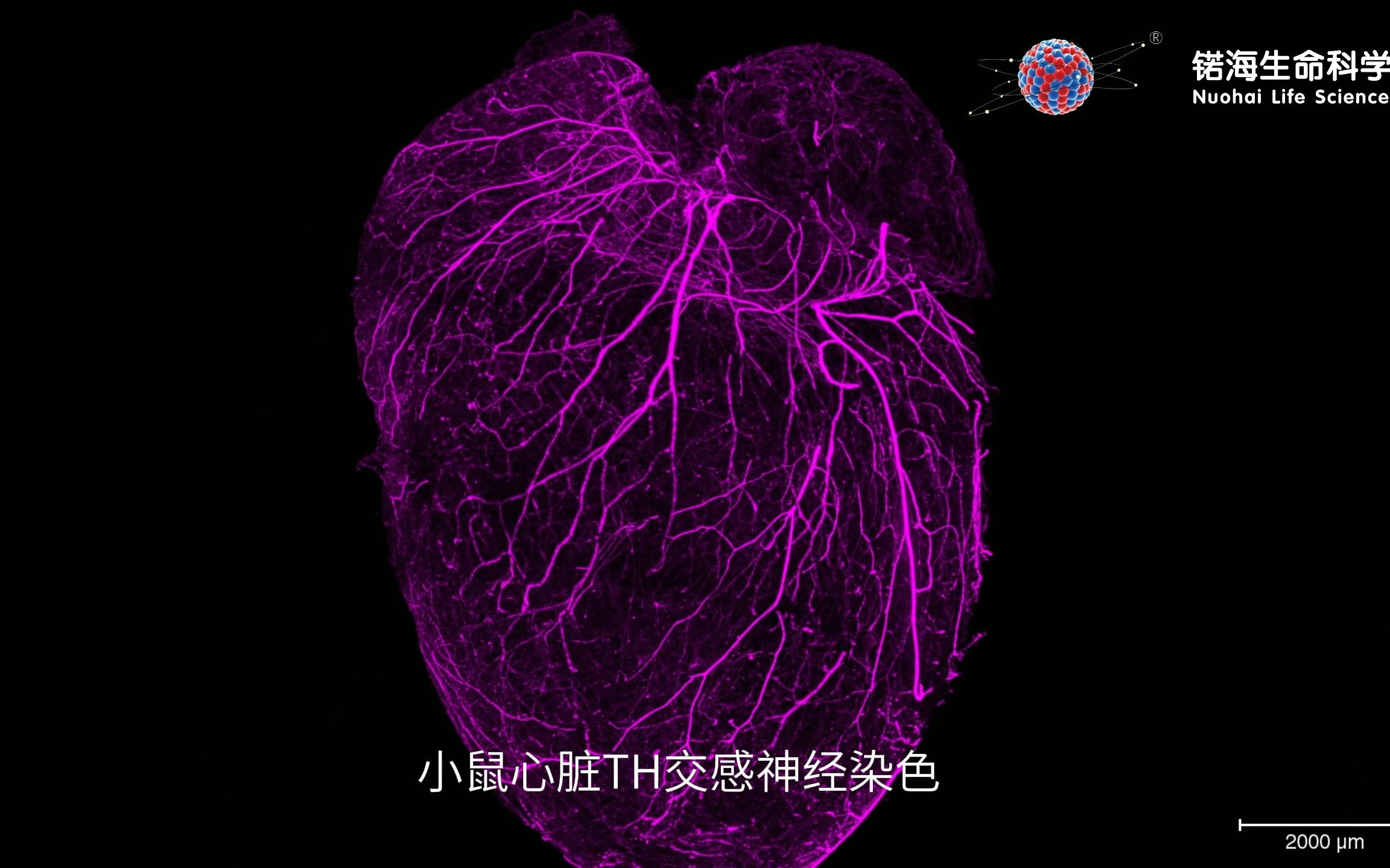 小鼠心脏、脾脏、肾脏3D荧光成像,TH交感神经染色,光片荧光显微镜拍摄哔哩哔哩bilibili