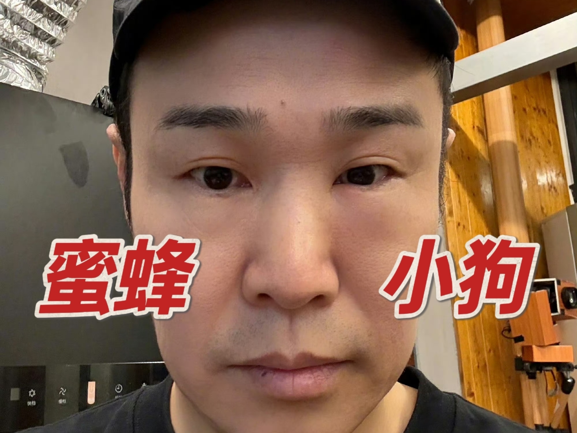【直播回放】小沈阳眼睛肿成蜜蜂小狗，但不忘给李光洁做土豆炖茄子
