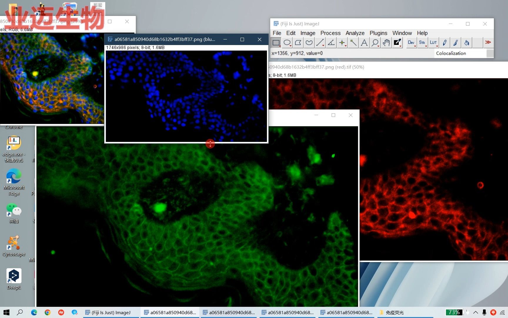 Fiji(imageJ)中免疫荧光图片分解与合成哔哩哔哩bilibili