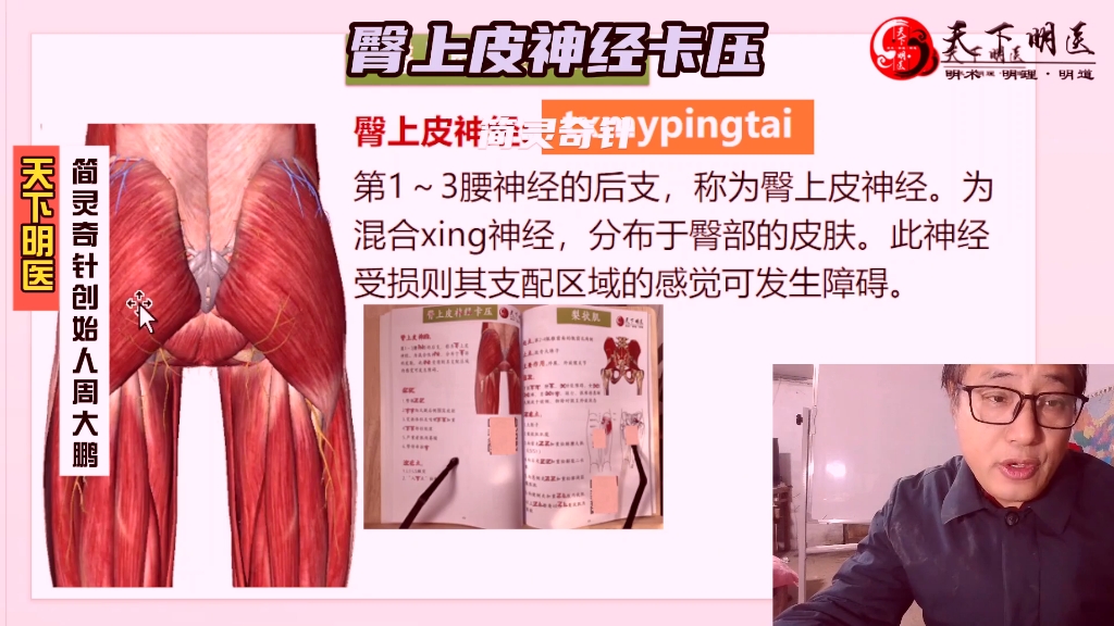 臀上皮神经卡压——4个方面全方位讲解——天下明医平台简灵奇针