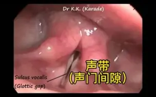 Video herunterladen: 看看声带是如何闭合的