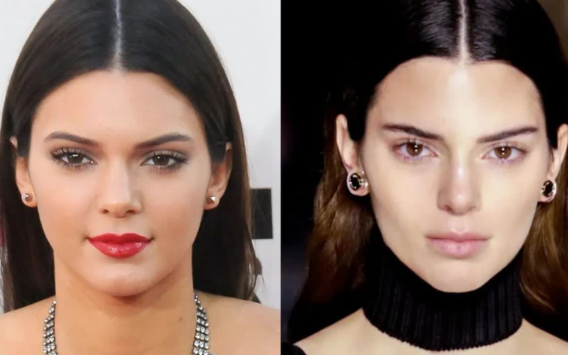 kuwtk肯豆整形史大剖析kendalljennerplasticsurgeryupdatebody