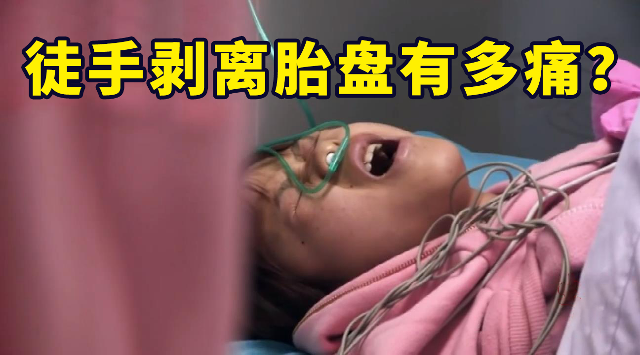 [图]徒手剥离胎盘有多痛？ 每一对母子，都是生死之交！