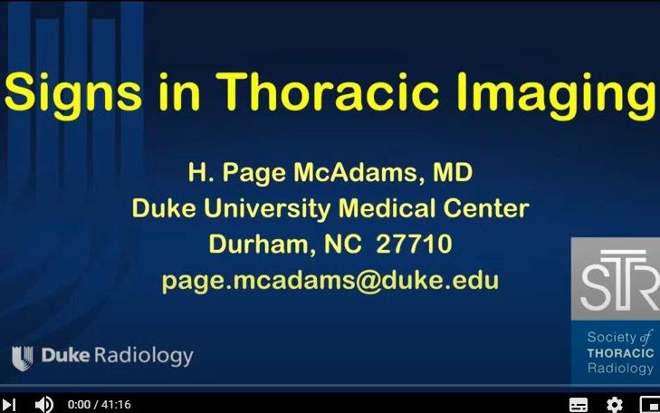 [图]1 Signs in Thoracic Imaging - Page McAdams