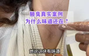 Tải video: 两次狐臭手术后还有味道，原因竟然是这个