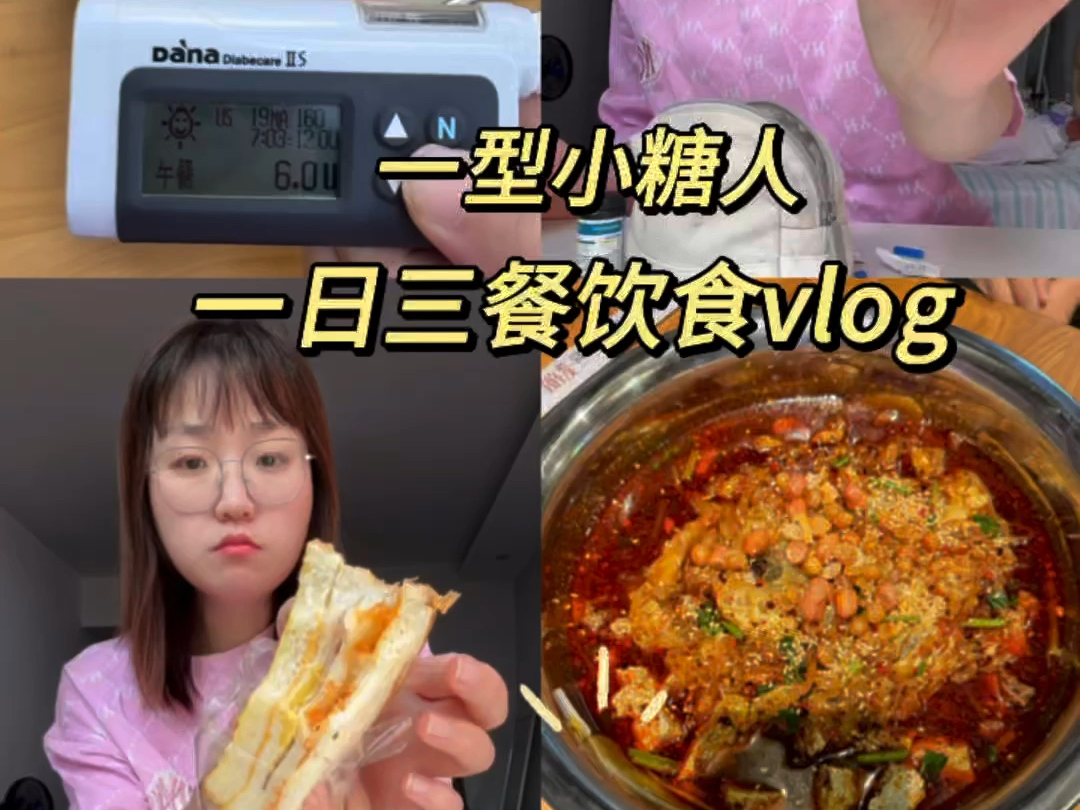 一型糖尿病日常vlog今天消费23.5U胰岛素吃饭!哔哩哔哩bilibili