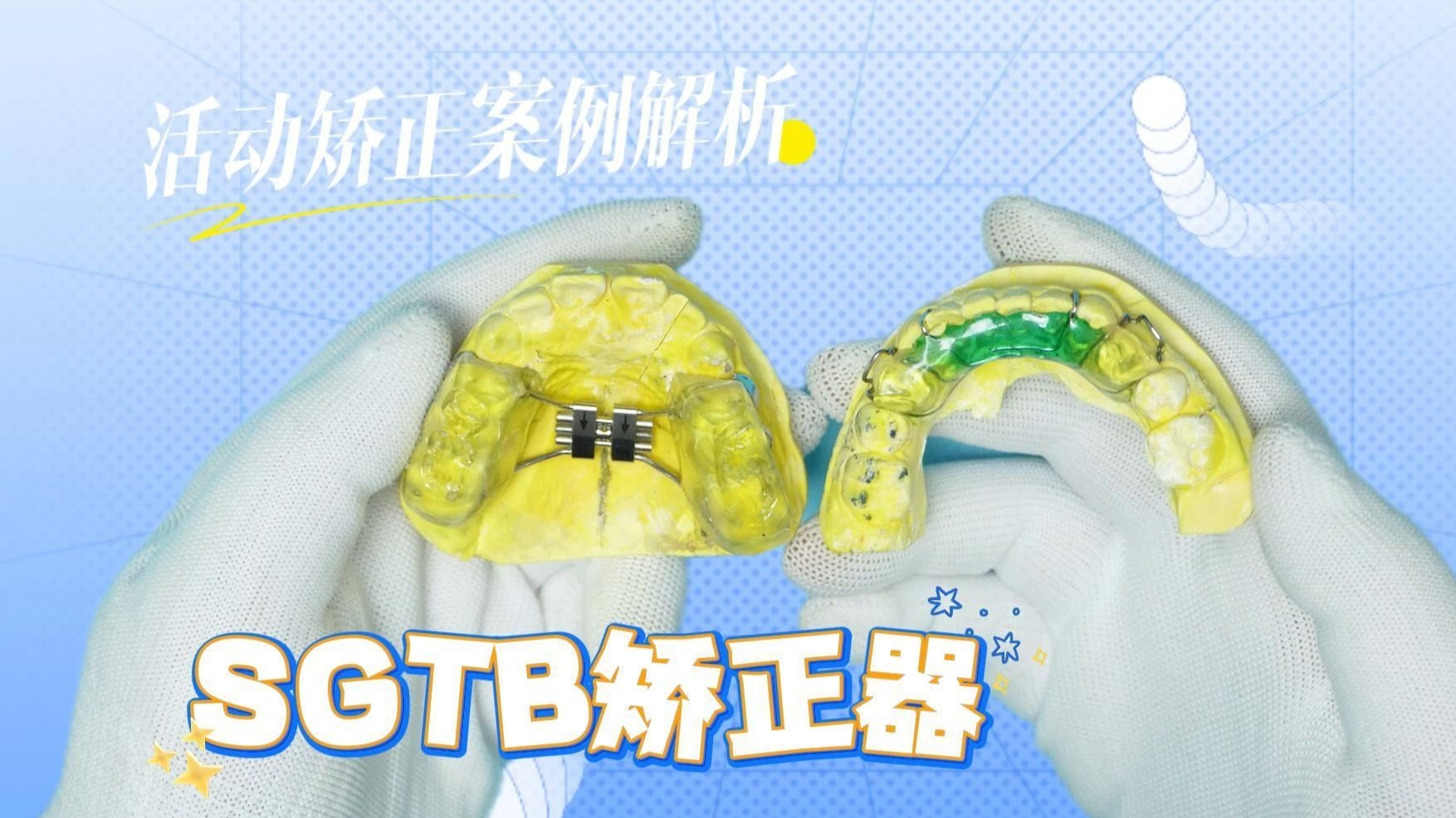 sgtb矫正器 妃她正畸 儿童牙齿矫正器 活动矫正器