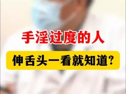 Tải video: 手淫过度肾虚了 从舌头上就能看出来