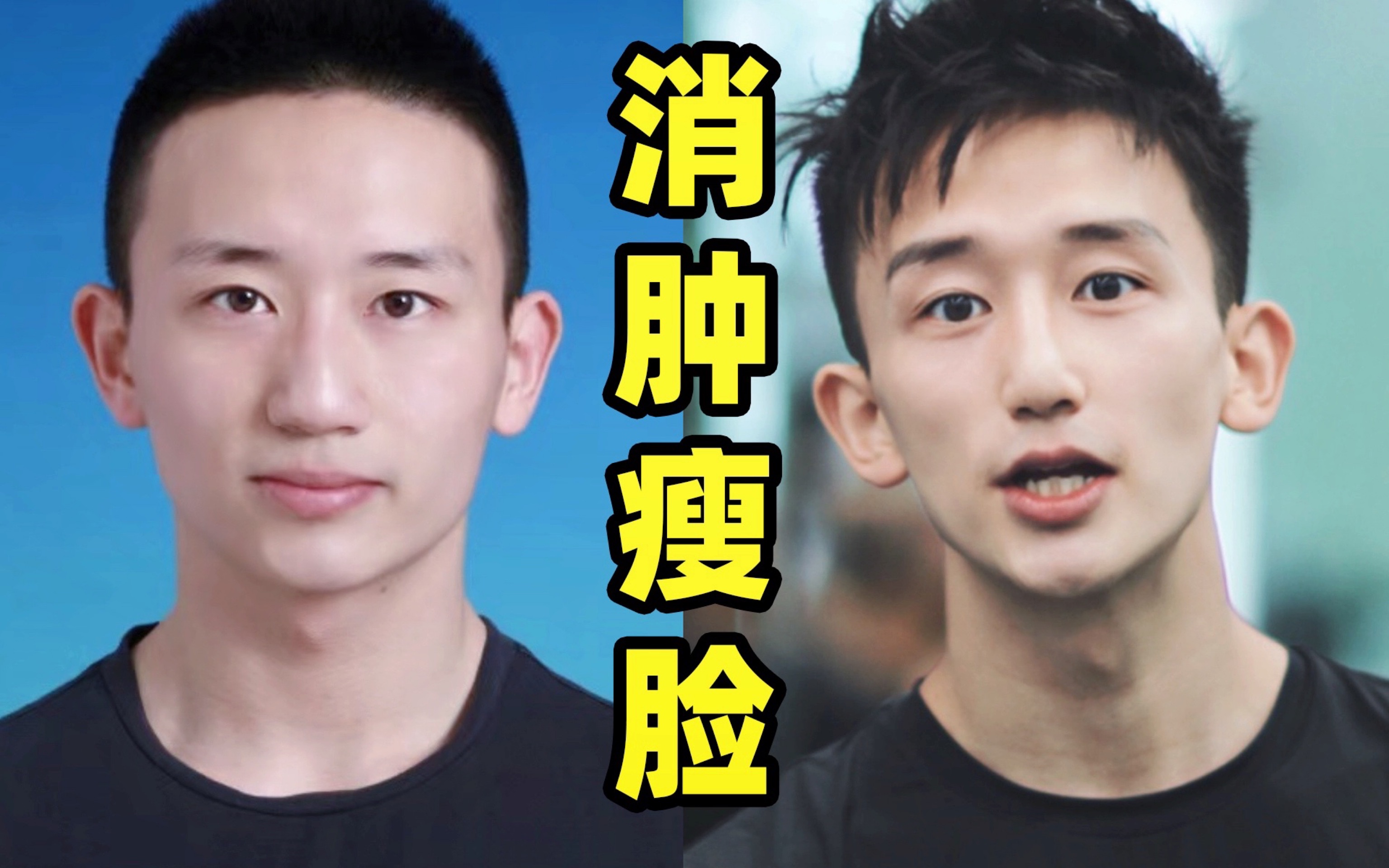 0成本快速消肿瘦脸大法丨拯救水肿脸,鱼泡眼,易肿体质必看!