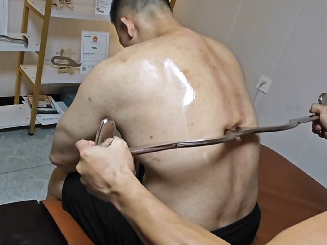 肯定疼，疼疼疼～