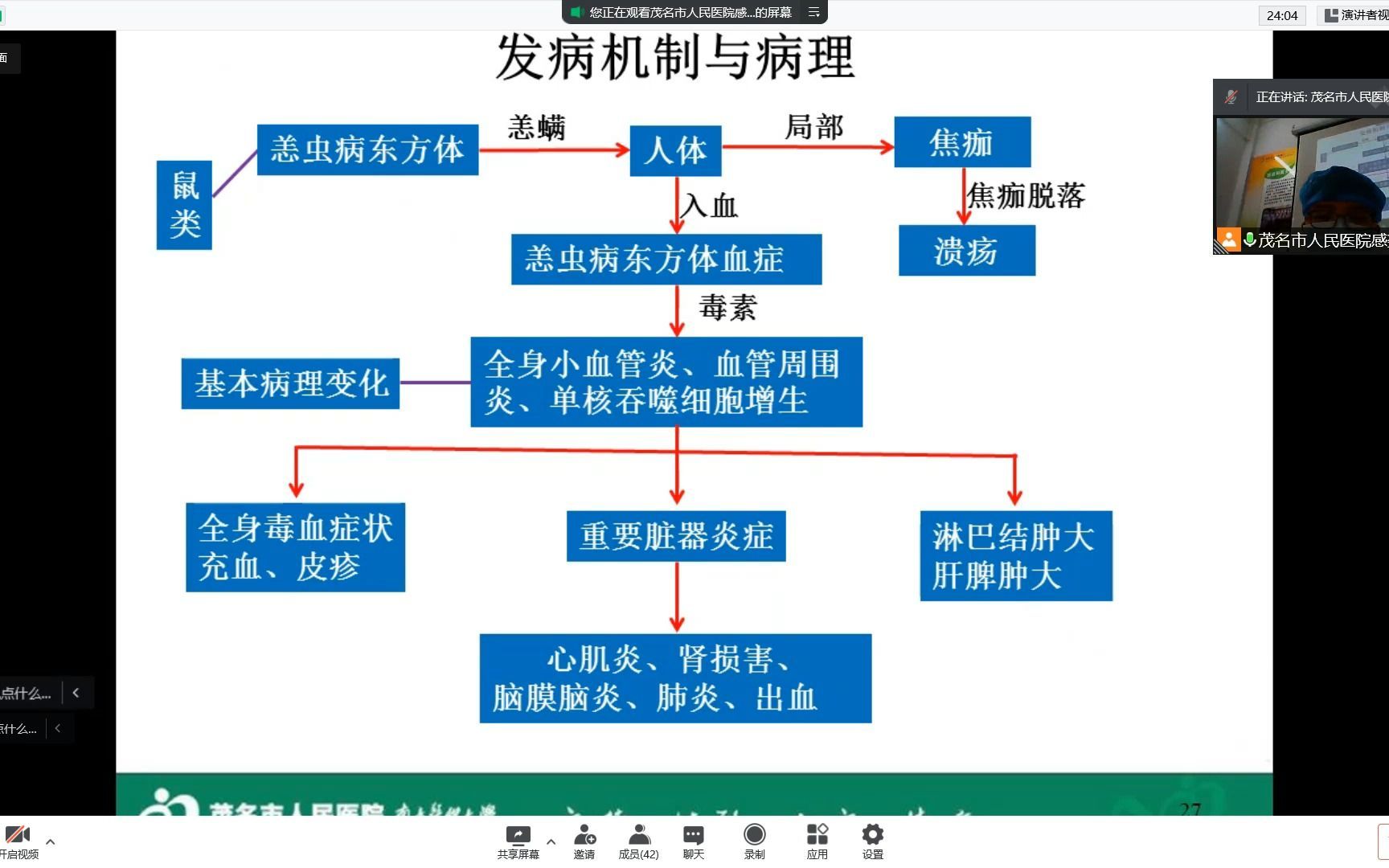 恙虫病20220421集体备课哔哩哔哩bilibili