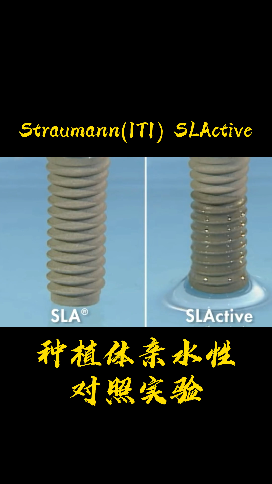 士卓曼(Straumann, ITI)S哔哩哔哩bilibili