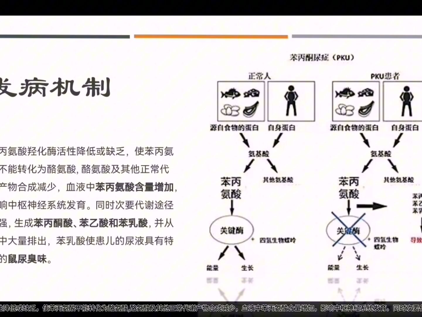 苯丙酮尿症发病机制图片