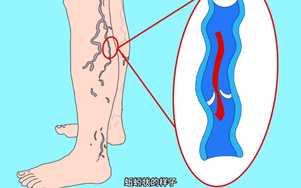 [图]【疾病解说】最新视频来袭，快来看看吧！