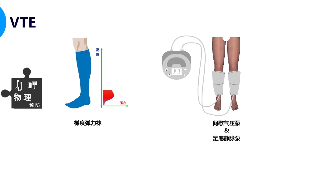 [图]医院内静脉血栓栓塞症（VTE）规范管理视频