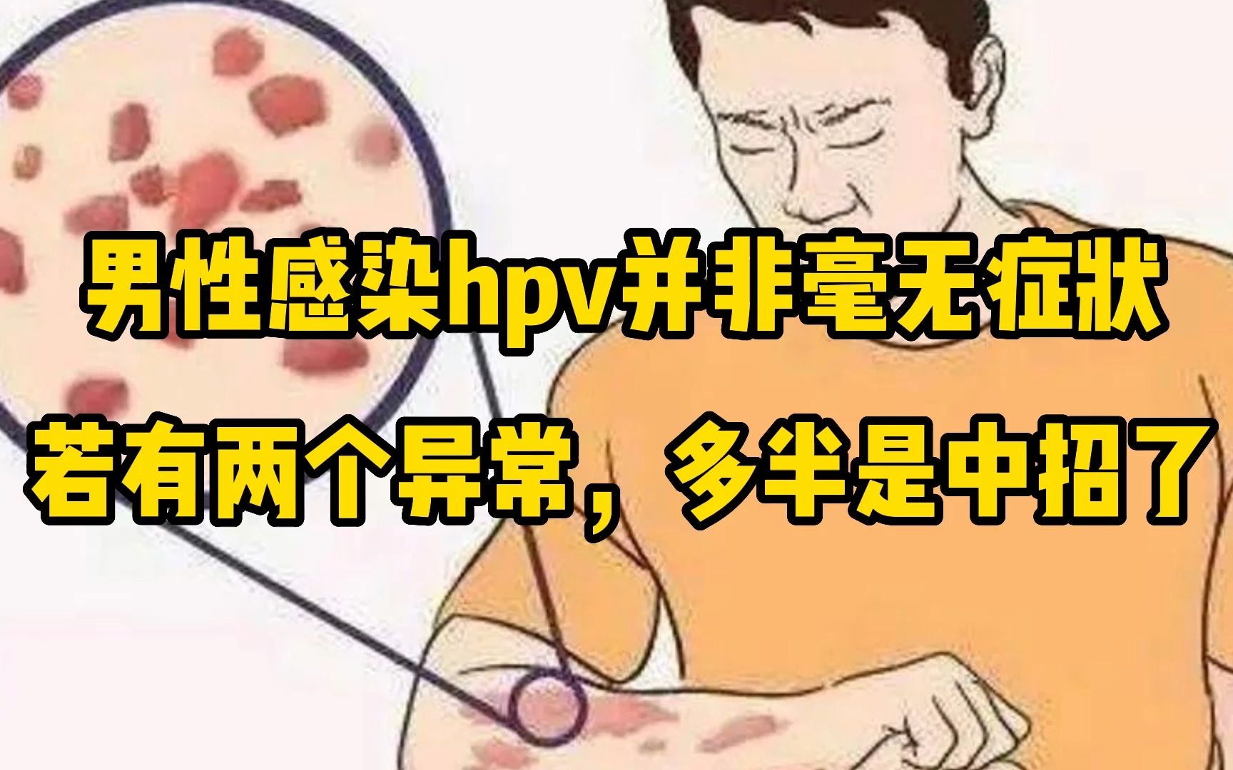 這兩種男人十有八九是hpv攜帶者,明眼人一看便知,注意遠離