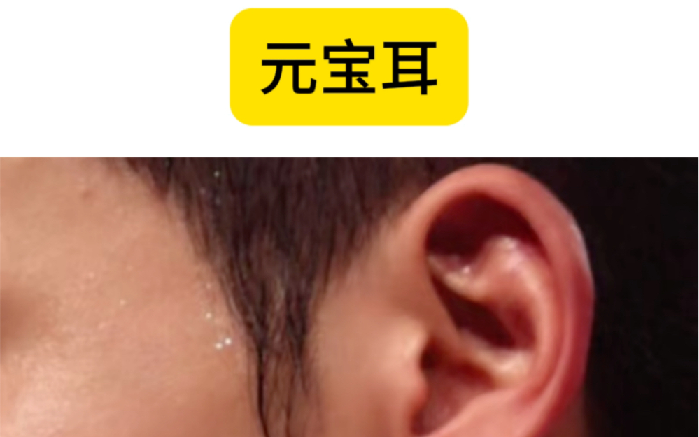 元宝耳到底是不是富贵耳?一讲就明白!
