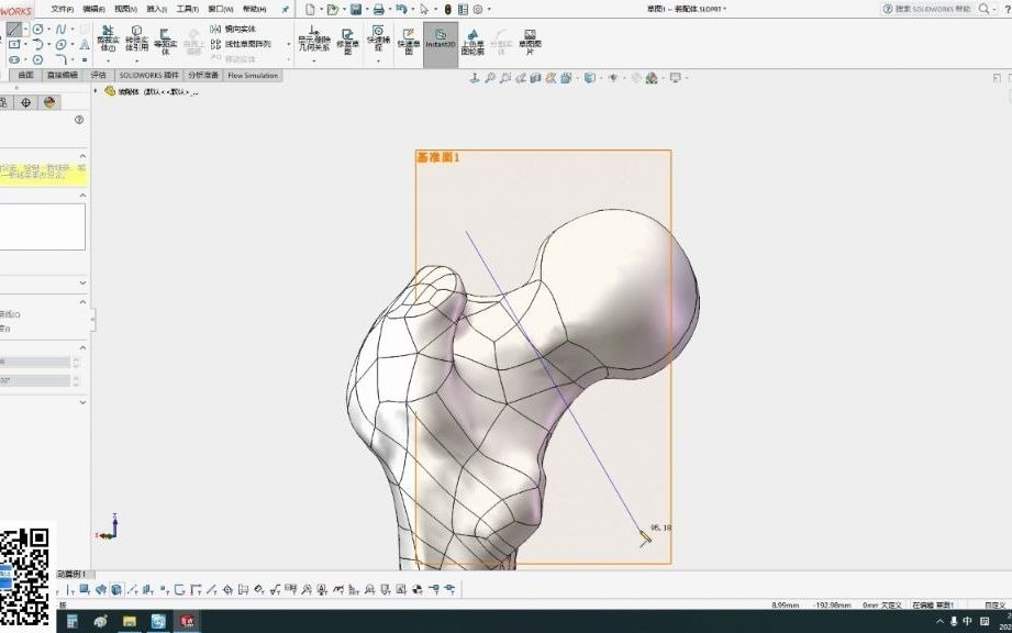 股骨有限元分析(生物力学 B)利用Solidworks创建钢板、螺钉、假体等并做骨头装配工作哔哩哔哩bilibili