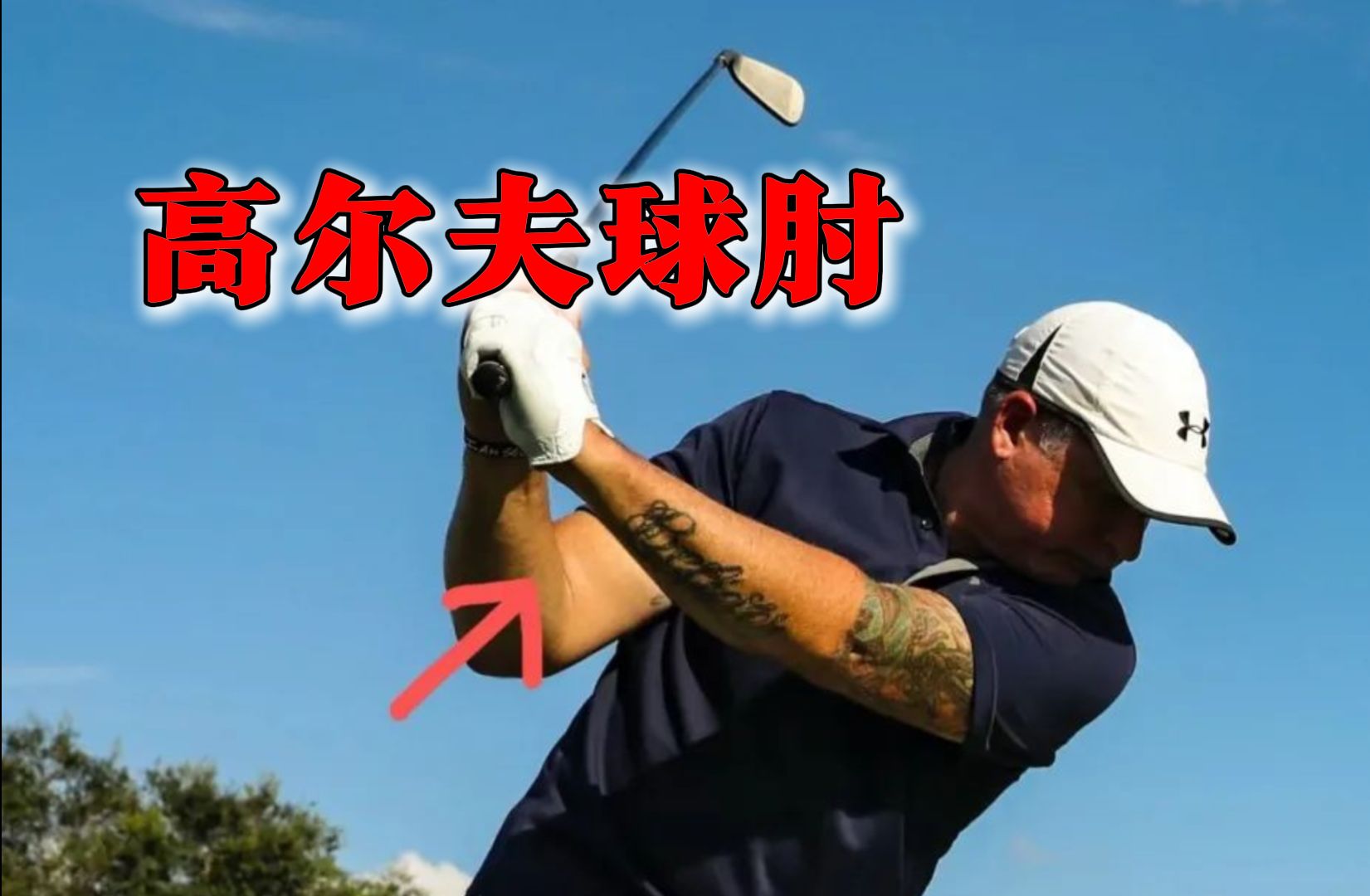 高尔夫球肘|肱骨内上髁炎,3个动作帮你改善