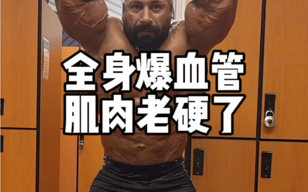 和阿诺比差远了,阿诺能做到只爆血管毫无分离度