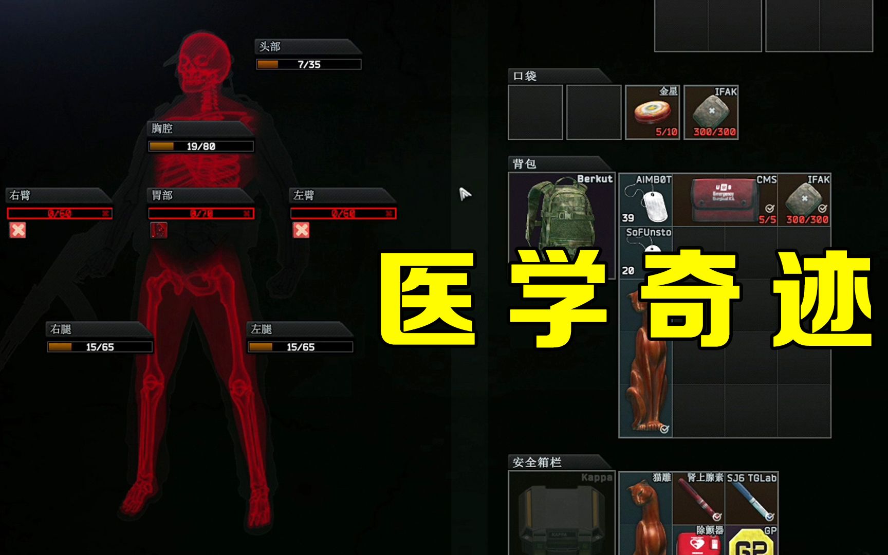 医学奇迹逃离塔科夫