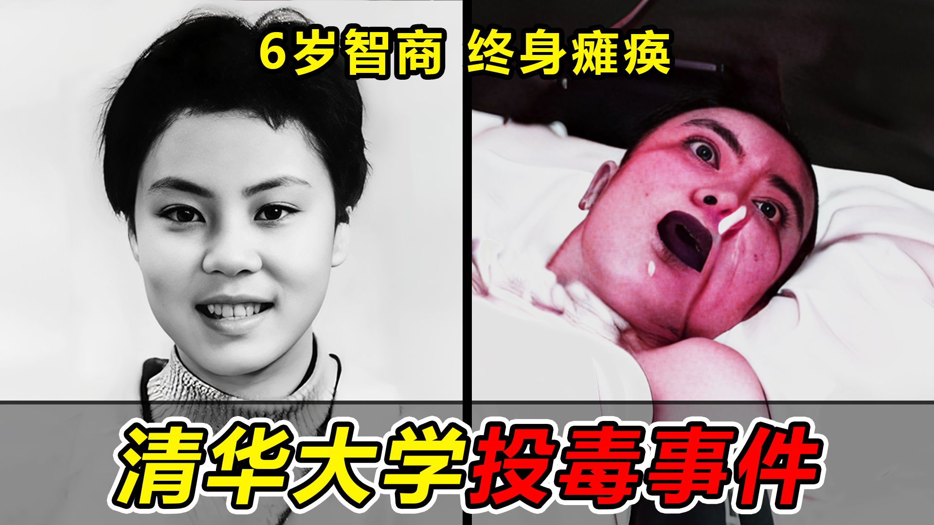 清华女学霸被投剧毒,智商回到6岁,终身瘫痪,凶手至今成谜,深扒朱令案-蓝星人-ET-蓝星人-ET-哔哩哔哩视频