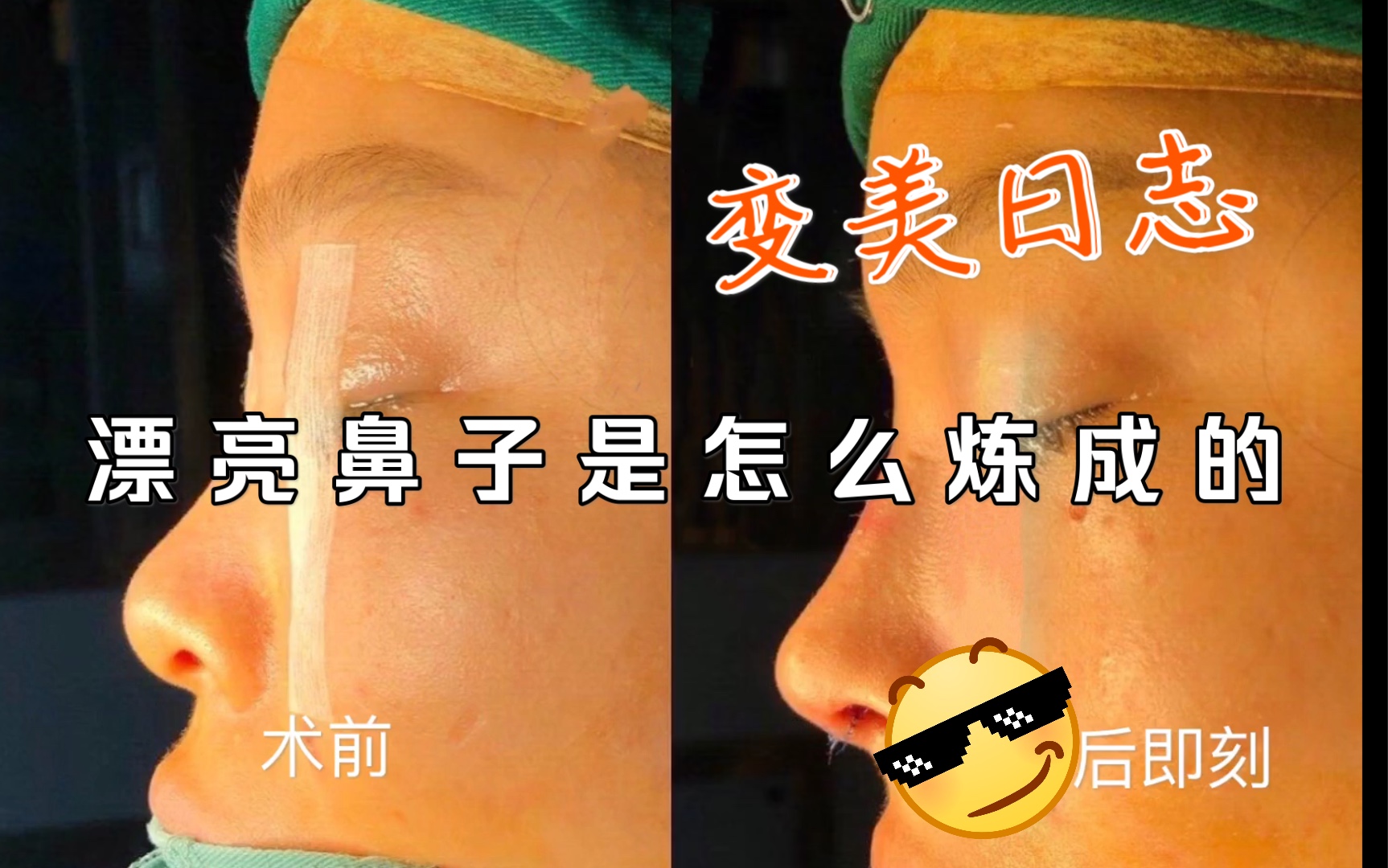 看下即刻效果,能猜出这个鼻型是哪位明星的么?