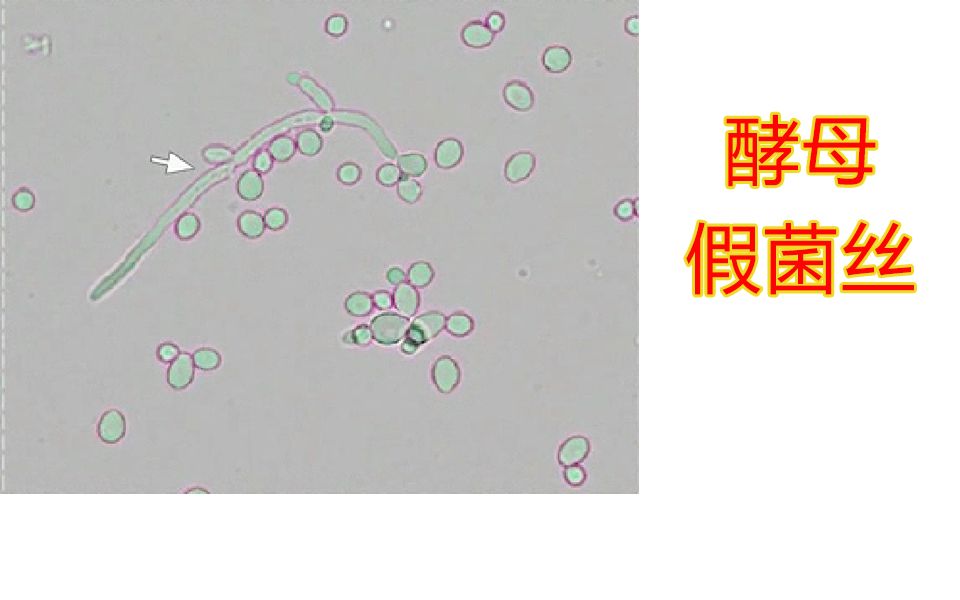 【实验】酵母假菌丝的观察,什么是假菌丝哔哩哔哩bilibili