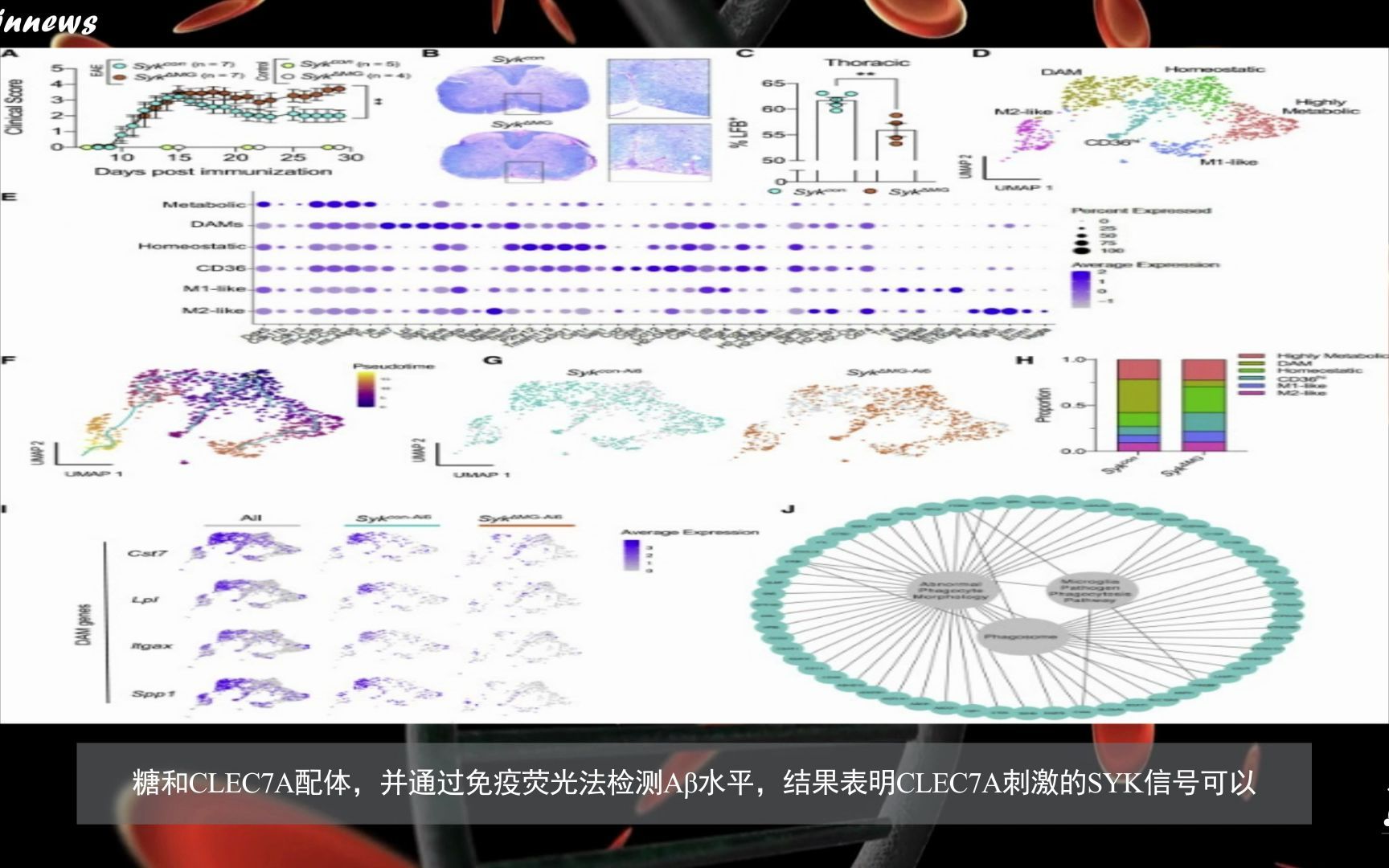 [图]#Brainnews 【前沿快讯】Cell：小胶质细胞导致阿尔茨海默病Aβ沉积加剧、神经病理加重和认知缺陷的新机制