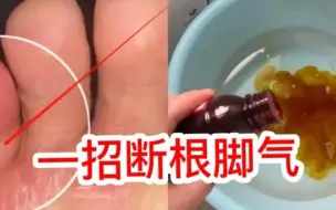 Descargar video: 碘伏泡脚：摆脱脚臭的秘密武器，消灭真菌从脚底开始！