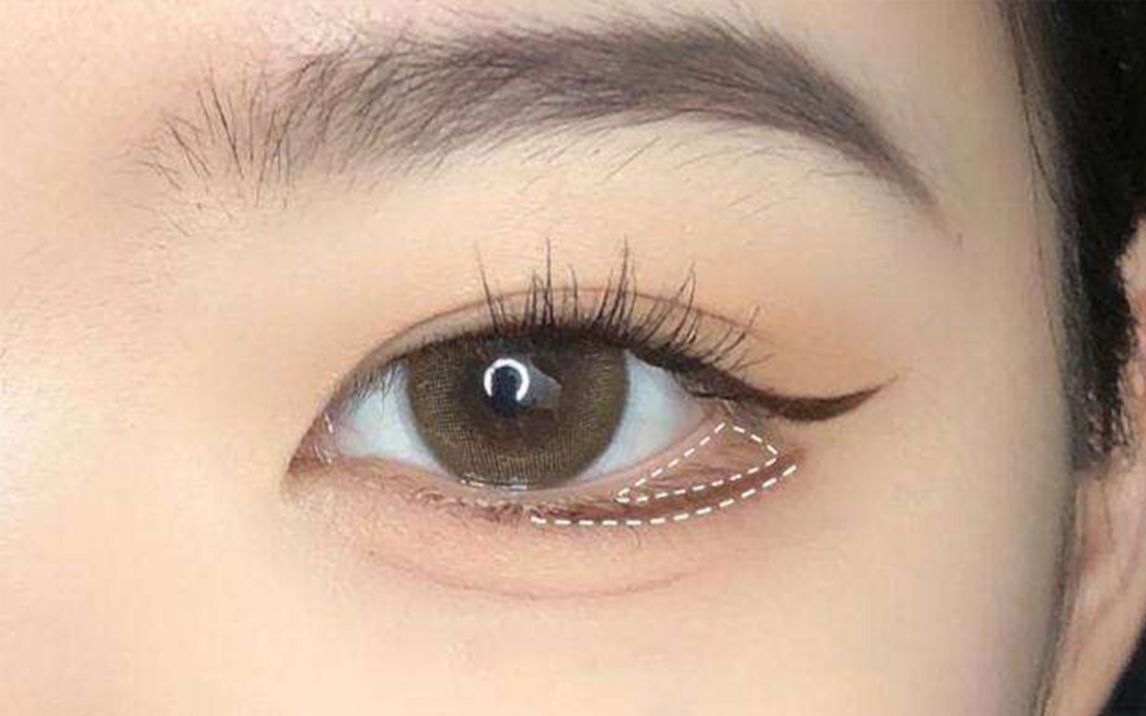 【摄影日结】人像液化-眼睑下至对脸部眼睛液化的帮助