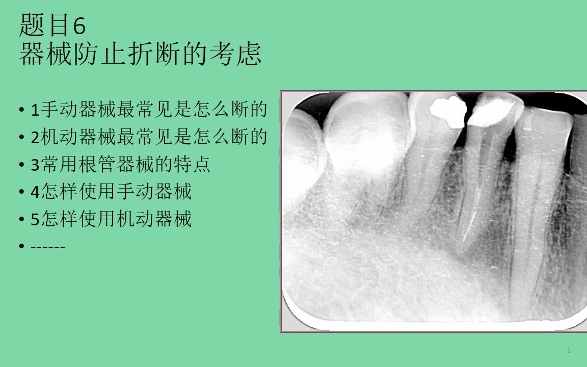 根管治疗中遇到的10类问题赵奇15H(口腔课程)哔哩哔哩bilibili