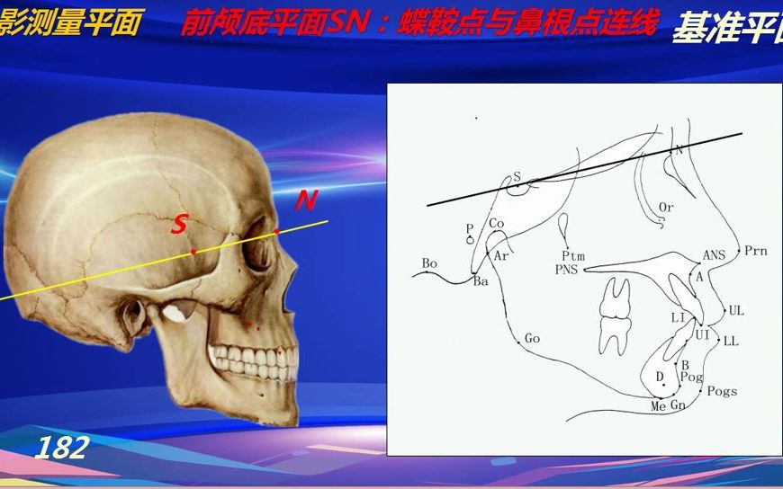 22第二章错颌畸形概述15头影测量3、常用测量项目哔哩哔哩bilibili