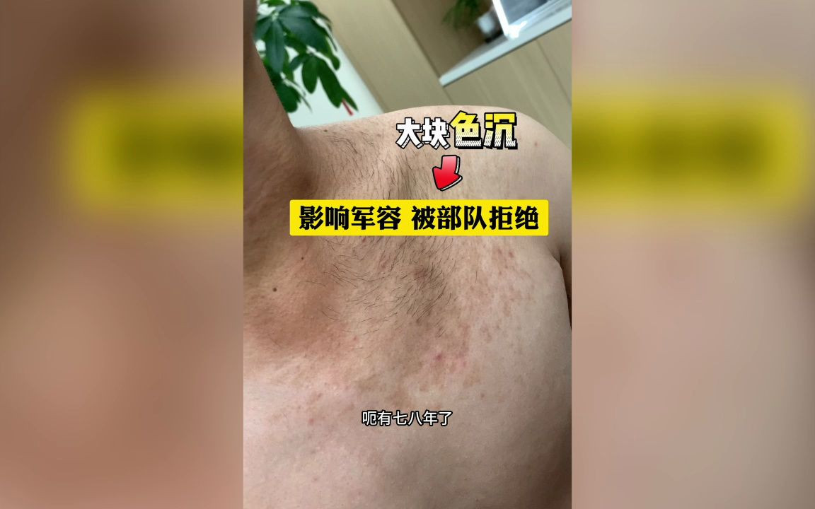 温馨提示:身上纹身,胎记,大块色沉兵检都过不了关哦