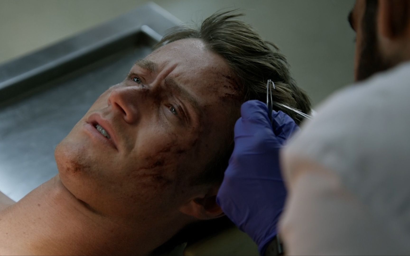 甄甄美剧我是僵尸第一季第六集解说在国外没交医疗保险受伤都不敢去