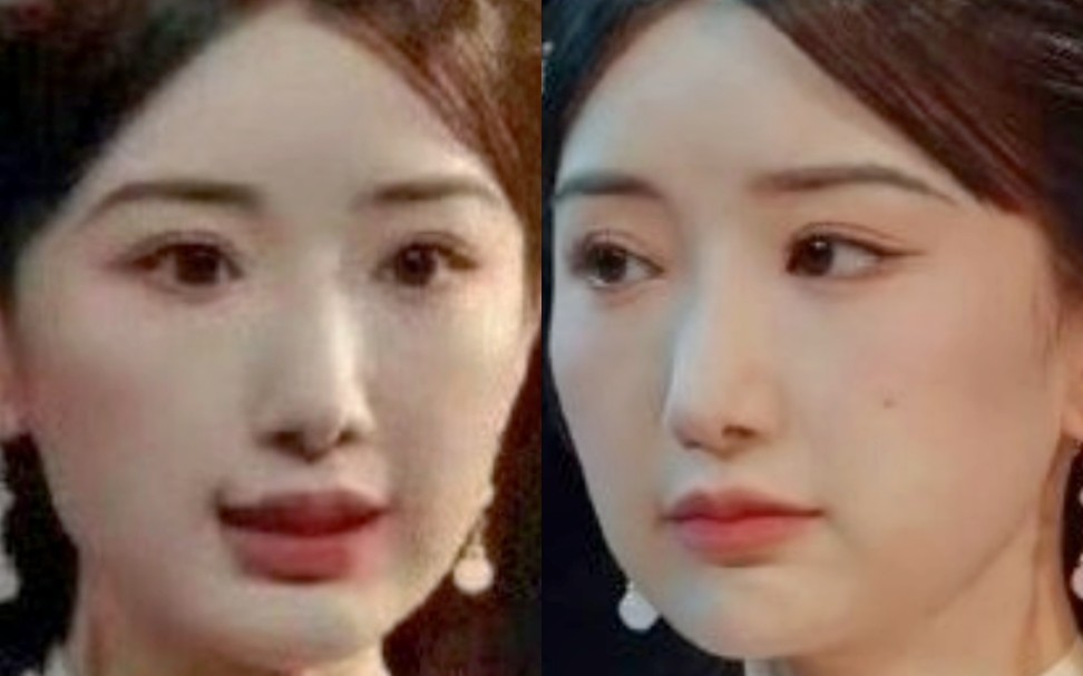 毛晓彤的脸怎么又又又动了 彻底回不去甜妹风了 她甄嬛传后面整容痕迹