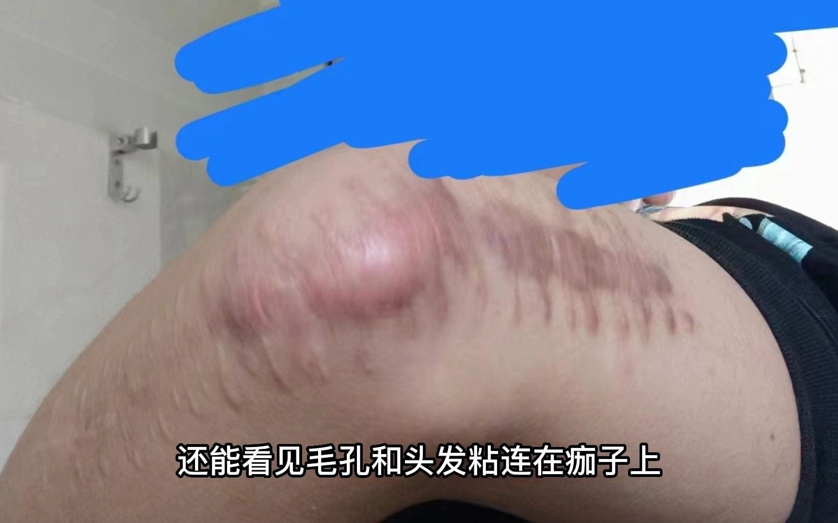 [图]一只跳楼鼠的故事，希望大家都要珍爱生命啊，附带采访视频